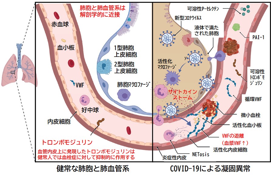 ストーム やすい サイトカイン 人 なり コロナ重症化招く「免疫の暴走」 抑制期待の治療薬は？